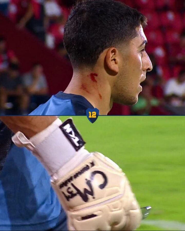 Leandro Brey fue herido durante la entrada en calor